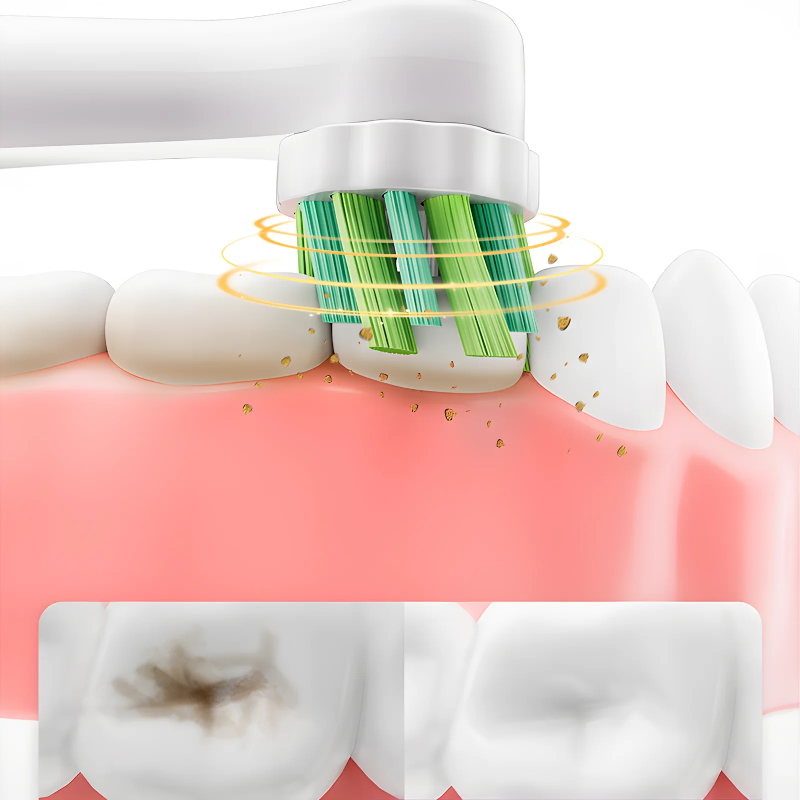 Grin Teeth ET 2 – 360° Rotating Brush for Deep Cleaning Grin Teeth ET 2 electric toothbrush demonstrating 360-degree rotating bristles removing plaque from all angles