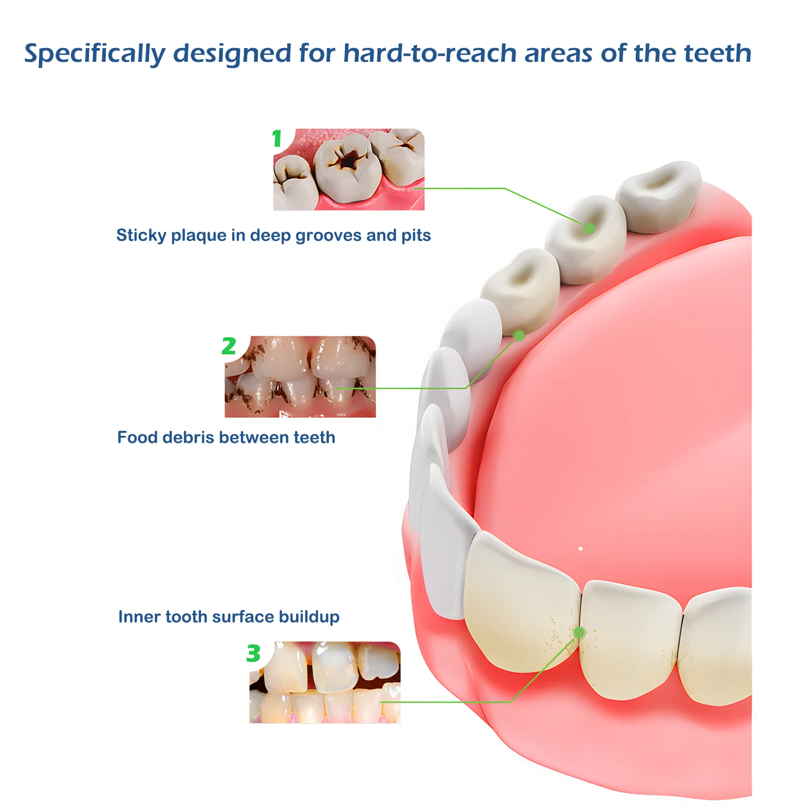 Grin Teeth ET 2 – Cleans Hard to Reach Tooth Areas Grin Teeth ET 2 toothbrush targeting plaque in grooves, food between teeth, and inner tooth buildup