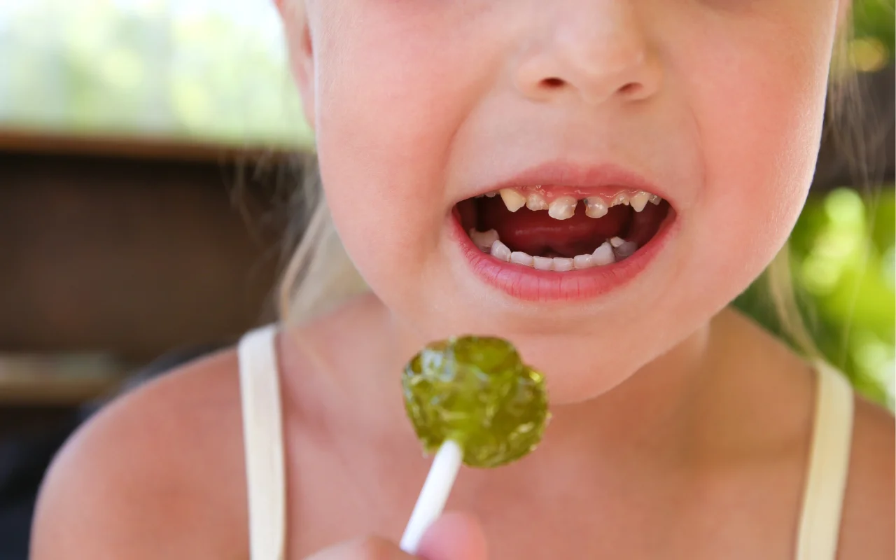 Child eating a lollipop—higher tooth decay risk; early childhood caries can appear as white or brown spots on primary teeth.